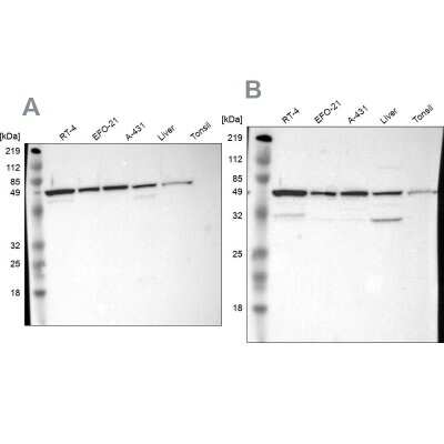 Western Blot: CKAP4/p63 Antibody [NBP1-85572]