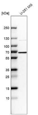 Western Blot: CKAP4/p63 Antibody [NBP2-55266]