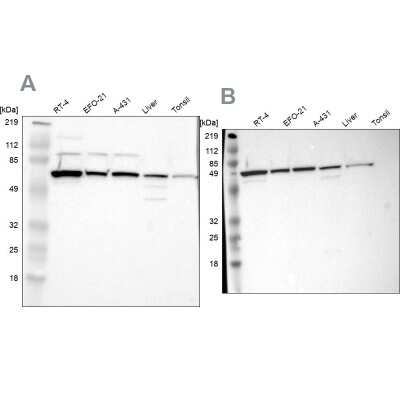 Western Blot: CKAP4/p63 Antibody [NBP2-55266]