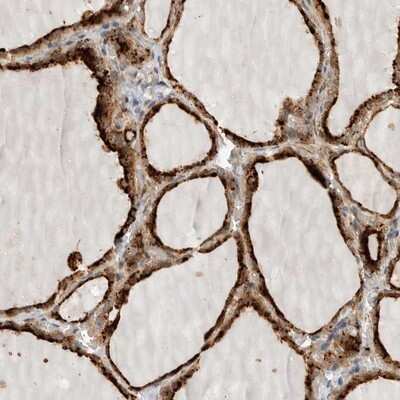 Immunohistochemistry-Paraffin: CKI gamma 3 Antibody [NBP1-91045]