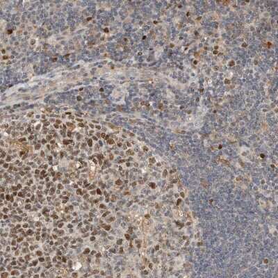 Immunohistochemistry-Paraffin: CKI gamma 3 Antibody [NBP1-91045]