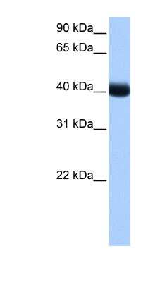 Western Blot: CKI gamma 3 Antibody [NBP1-57573]