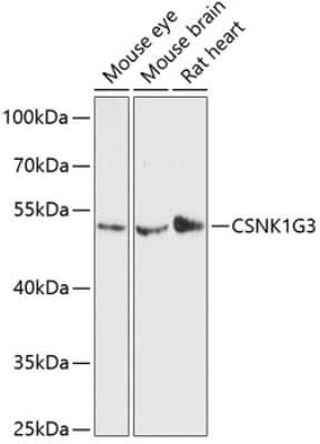 Western Blot: CKI gamma 3 AntibodyAzide and BSA Free [NBP2-92102]