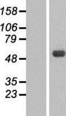 Western Blot: CKI gamma 3 Overexpression Lysate [NBL1-09535]