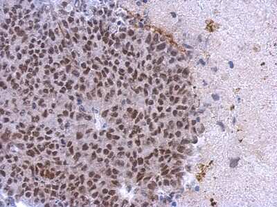 Immunohistochemistry-Paraffin: Casein Kinase 2 alpha Antibody [NBP2-15909]