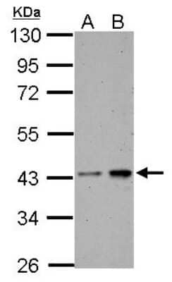 Western Blot: Casein Kinase 2 alpha Antibody [NBP2-15909]