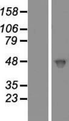 Western Blot: Casein Kinase 2 alpha Overexpression Lysate [NBP2-10787]