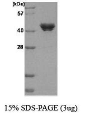 SDS-PAGE: Recombinant Human Casein Kinase 2 alpha His Protein [NBC1-18386]