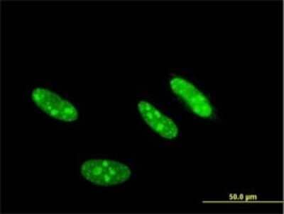 Immunocytochemistry/ Immunofluorescence: CKII alpha prime polypeptide Antibody (4F2) [H00001459-M01]