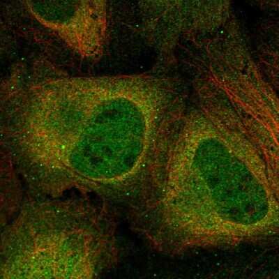 Immunocytochemistry/ Immunofluorescence: CKII alpha prime polypeptide Antibody [NBP2-57977]