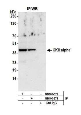 Immunoprecipitation: CKII alpha prime polypeptide Antibody [NB100-379]