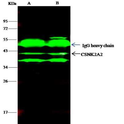 Immunoprecipitation: CKII alpha prime polypeptide Antibody [NBP2-99686]