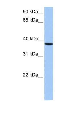 Western Blot: CKII alpha prime polypeptide Antibody [NBP1-56402]