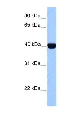 Western Blot: CKII alpha prime polypeptide Antibody [NBP1-56690]