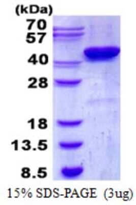 SDS-PAGE: Recombinant Human CKII alpha prime polypeptide His Protein [NBP2-22736]