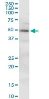 Western Blot: CKIP-1 Antibody [H00051177-B01P]