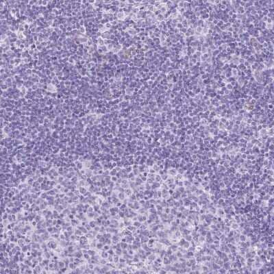 Immunohistochemistry-Paraffin: CKMT2 Antibody [NBP2-13841]