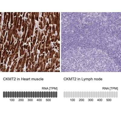 Immunohistochemistry-Paraffin: CKMT2 Antibody [NBP2-13841]