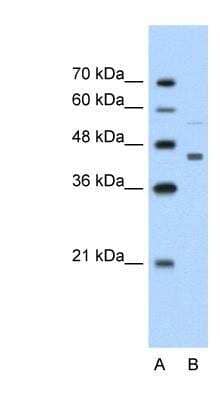 Western Blot: CKMT2 Antibody [NBP1-54661]