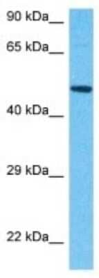 Western Blot: CKMT2 Antibody [NBP3-10786]