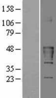 Western Blot: CKMT2 Overexpression Lysate [NBL1-09223]