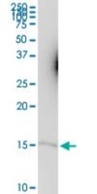 Western Blot: CKS1 Antibody [H00001163-B01P]