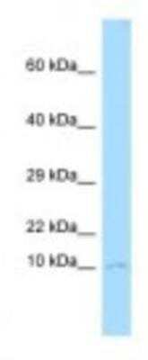 Western Blot: CKS1 Antibody [NBP1-98307]