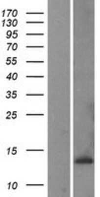 Western Blot: CKS1 Overexpression Lysate [NBP2-04207]