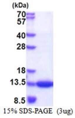 SDS-PAGE: Recombinant Human CKS1 His Protein [NBP2-51527]