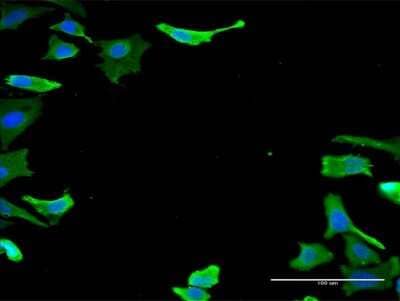 Immunocytochemistry/ Immunofluorescence: CKS2 Antibody (1G8) [H00001164-M03]