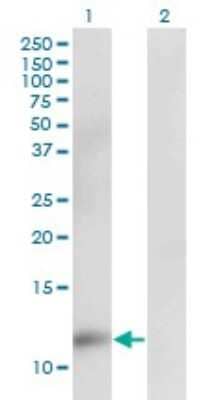 Western Blot: CKS2 Antibody (2G12-2A5) [H00001164-M02]