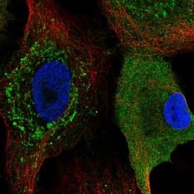 Immunocytochemistry/ Immunofluorescence: CKS2 Antibody [NBP2-58720]