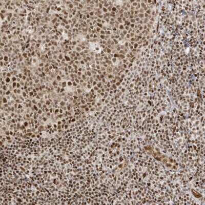 Immunohistochemistry-Paraffin: CKS2 Antibody [NBP1-86336]