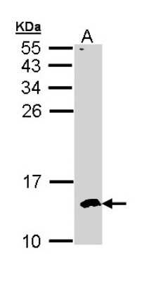 Western Blot: CKS2 Antibody [NBP1-33404]