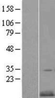 Western Blot: CKS2 Overexpression Lysate [NBL1-09225]