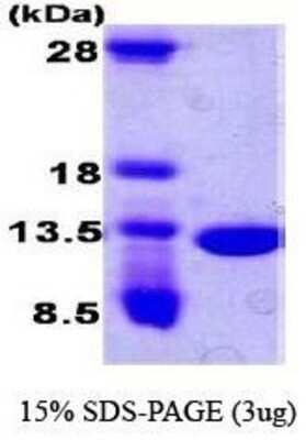 SDS-PAGE: Recombinant Human CKS2 T7 Protein [NBC1-18431]