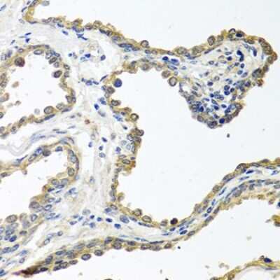 Immunohistochemistry-Paraffin: CL-K1/COLEC11 Antibody - Azide and BSA Free [NBP2-92785]