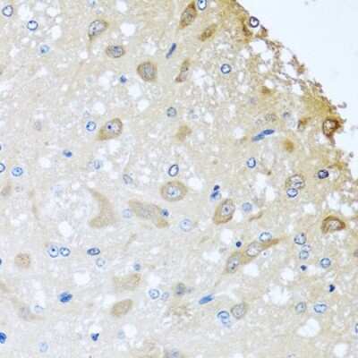 Immunohistochemistry-Paraffin: CL-K1/COLEC11 Antibody - Azide and BSA Free [NBP2-92785]