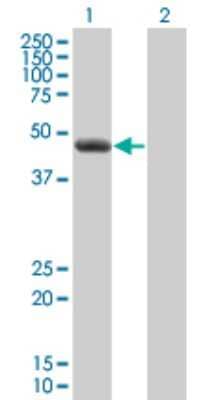 Western Blot: CLP1/HEAB Antibody (8D5) [H00010978-M01]