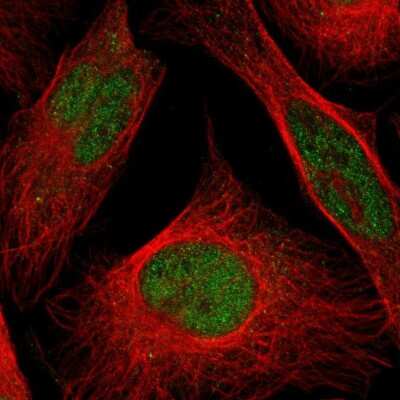 Immunocytochemistry/ Immunofluorescence: CLP1/HEAB Antibody [NBP2-33847]