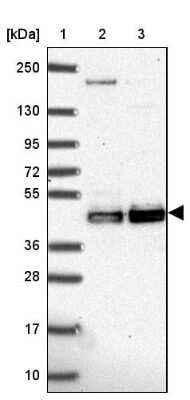 Western Blot: CLP1/HEAB Antibody [NBP2-33847]