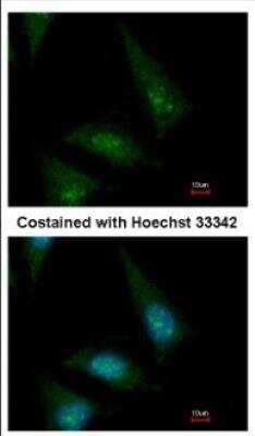 Immunocytochemistry/ Immunofluorescence: CLASP1 Antibody [NBP2-15910]