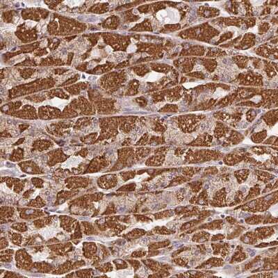 Immunohistochemistry: CLASP1 Antibody [NBP2-39049]