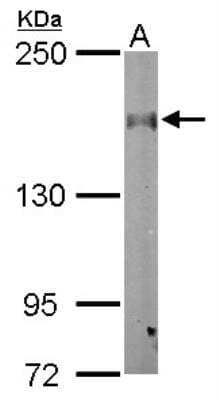 Western Blot: CLASP1 Antibody [NBP2-15910]