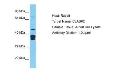 Western Blot: CLASP2 Antibody [NBP2-87192]