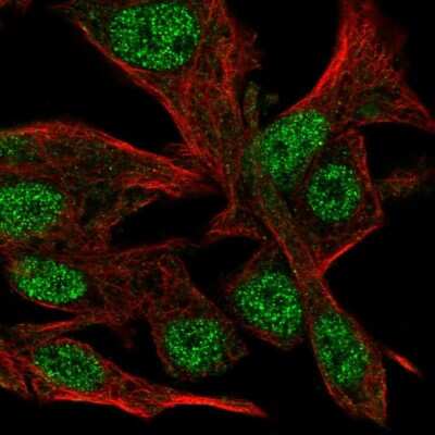 Immunocytochemistry/ Immunofluorescence: CLASRP Antibody [NBP2-32548]
