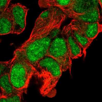 Immunocytochemistry/ Immunofluorescence: CLASRP Antibody [NBP2-56062]