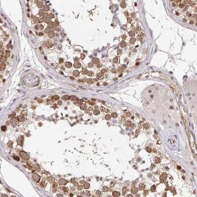 Immunohistochemistry-Paraffin: CLASRP Antibody [NBP2-32548]