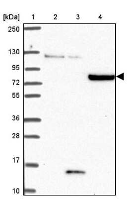 Western Blot: CLASRP Antibody [NBP2-32548]