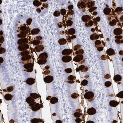 Immunohistochemistry: CLCA1 Antibody [NBP2-38869]